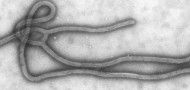 ebola virus